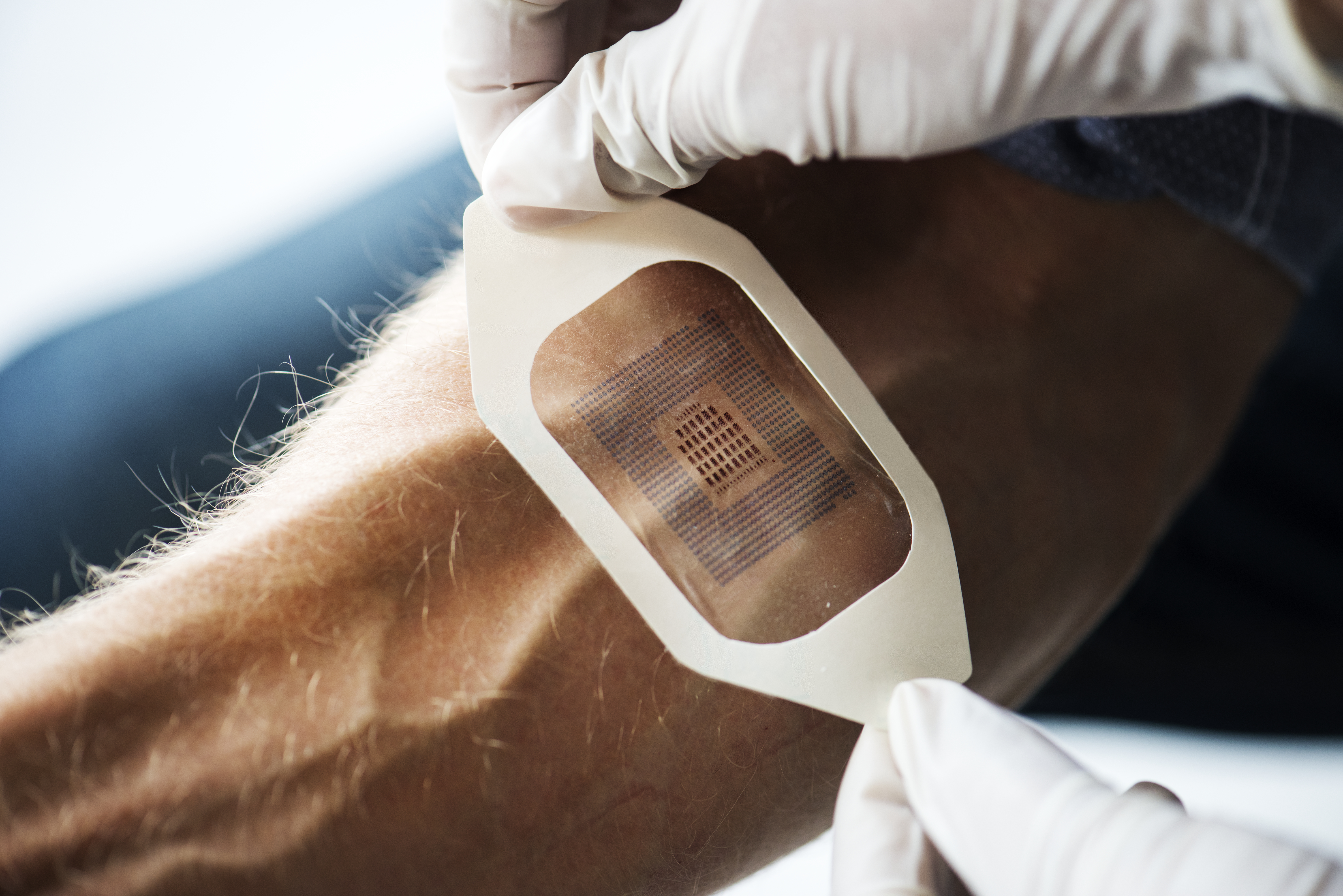 Carry - Transdermal Patch